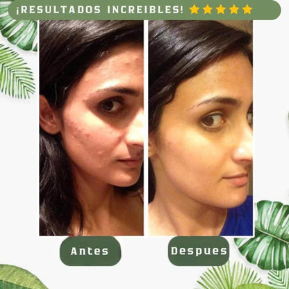 ⚡GREEN MASK® - MASCARILLA EXFOLIANTE + LIMPIEZA PROFUNDA ⚡