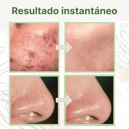 ⚡GREEN MASK® - MASCARILLA EXFOLIANTE + LIMPIEZA PROFUNDA ⚡